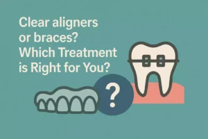 Clear Aligners or Braces Which Treatment Is Right for You?